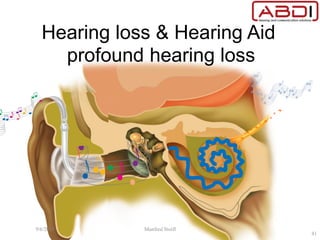Hearing loss & Hearing Aid
profound hearing loss
9/6/2015 Manfred Stoifl
41
 