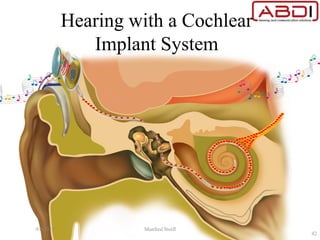 Hearing with a Cochlear
Implant System
9/6/2015 Manfred Stoifl
42
 