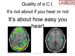 Quality of a C.I.
It’s not about if you hear or not
It’s about how easy you
hear!
9/6/2015 Manfred Stoifl
45
 