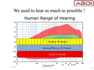We need to hear as much as possible !
Cochlear 22 Sounds
MedEl 16 Sounds
Advanced Bionics 120 Sounds
9/6/2015 Manfred Stoifl
48
 