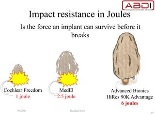 Impact resistance in Joules
Is the force an implant can survive before it
breaks
Cochlear Freedom
1 joule
MedEl
2.5 joule
Advanced Bionics
HiRes 90K Advantage
6 joules
9/6/2015 Manfred Stoifl
49
 