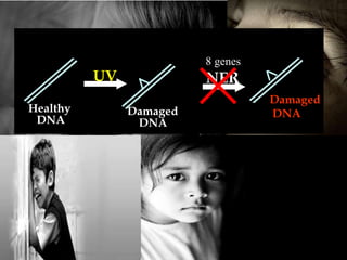 Children of the dark- XERODERMA PIGMENTOSUM | PPTX