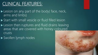 CLINICAL FEATURES:
 Lesion on any part of the body( face, neck,
arms and limbs)
 Start with small vesicle or fluid filled lesion
 Lesion then ruptures and fluid drains leaving
areas that are covered with honey coloured
crusts
 Swollen lymph nodes
 