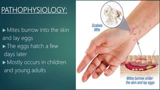 PATHOPHYSIOLOGY:
 Mites burrow into the skin
and lay eggs
 The eggs hatch a few
days later
 Mostly occurs in children
and young adults
 