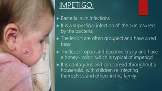 IMPETIGO:
 Bacterial skin infections
 It is a superficial infection of the skin, caused
by the bacteria
 The lesion are often grouped and have a red
base
 The lesion open and become crusty and have
a honey- color, ‘which is typical of impetigo’
 It is contagious and can spread throughout a
household, with children re infecting
themselves and others in the family
 