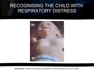 RECOGNISING THE CHILD WITH  RESPIRATORY DISTRESS Jamie Ranse :  Critical Care Education Coordinator, Staff Development Unit, ACT Health. 