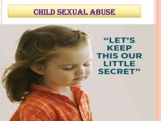 CHILD SEXUAL ABUSE
 