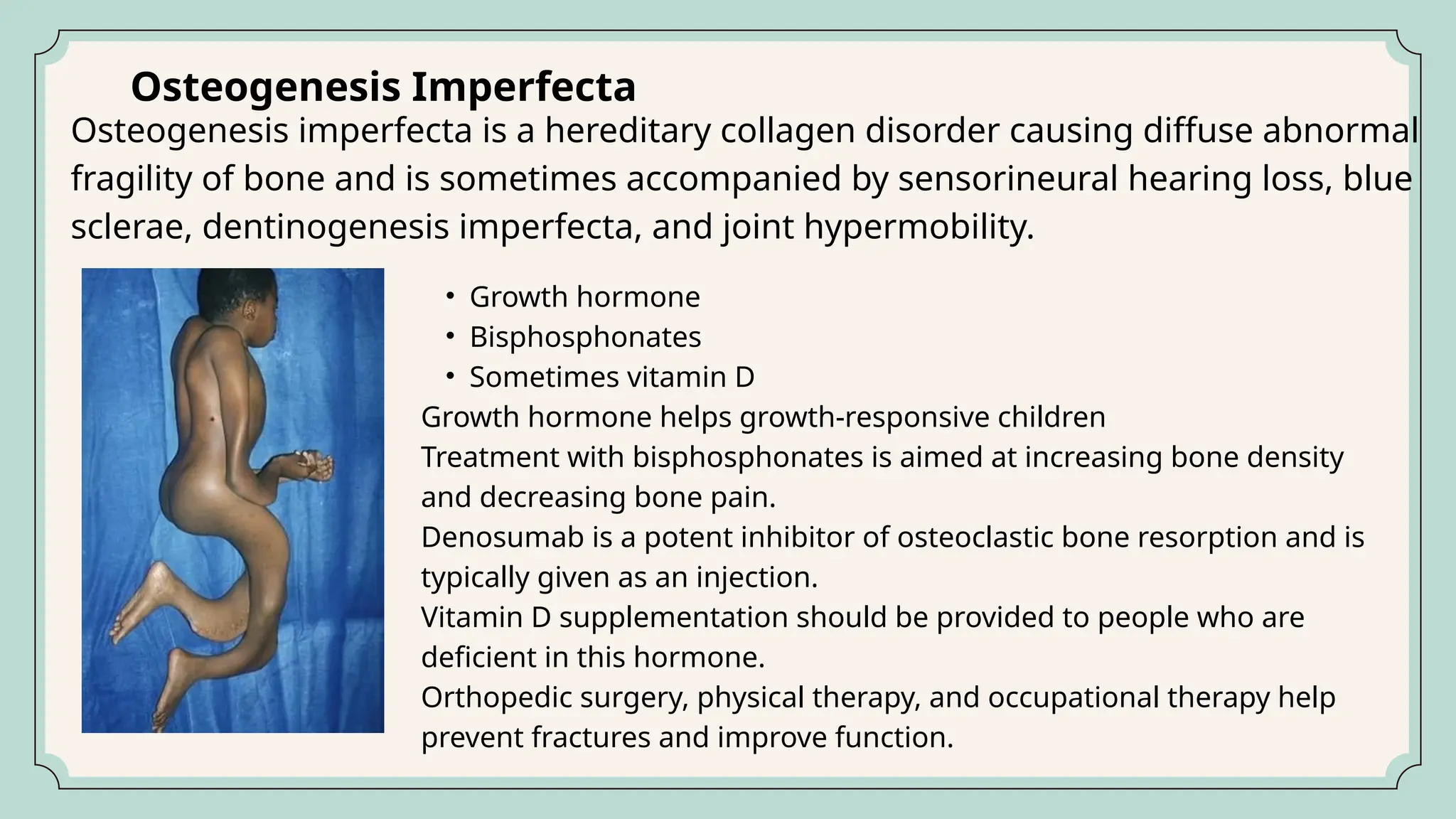 CHILD skeletal system and their diseases.pptx