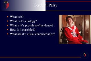 Cerebral Palsy What is it? What is it’s etiology? What is it’s prevalence/incidence? How is it classified? What are it’s visual characteristics? 