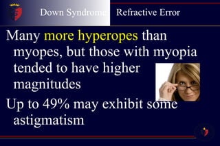 Down Syndrome  Refractive Error Many  more hyperopes  than myopes, but those with myopia tended to have higher magnitudes Up to 49% may exhibit some astigmatism 