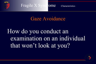 Fragile X Syndrome  Characteristics Gaze Avoidance How do you conduct an examination on an individual that won’t look at you? 