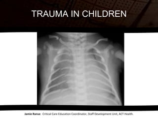 TRAUMA IN CHILDREN Jamie Ranse :  Critical Care Education Coordinator, Staff Development Unit, ACT Health. 