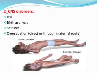 2_CNS disorders: 
ICH 
Birth asphyxia 
Seizures 
Oversedation (direct or through maternal route) 
 