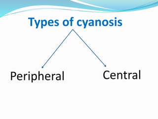 Types of cyanosis 
Peripheral Central 
 