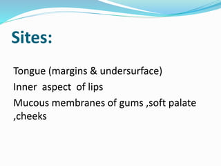 Sites: 
Tongue (margins & undersurface) 
Inner aspect of lips 
Mucous membranes of gums ,soft palate 
,cheeks 
 