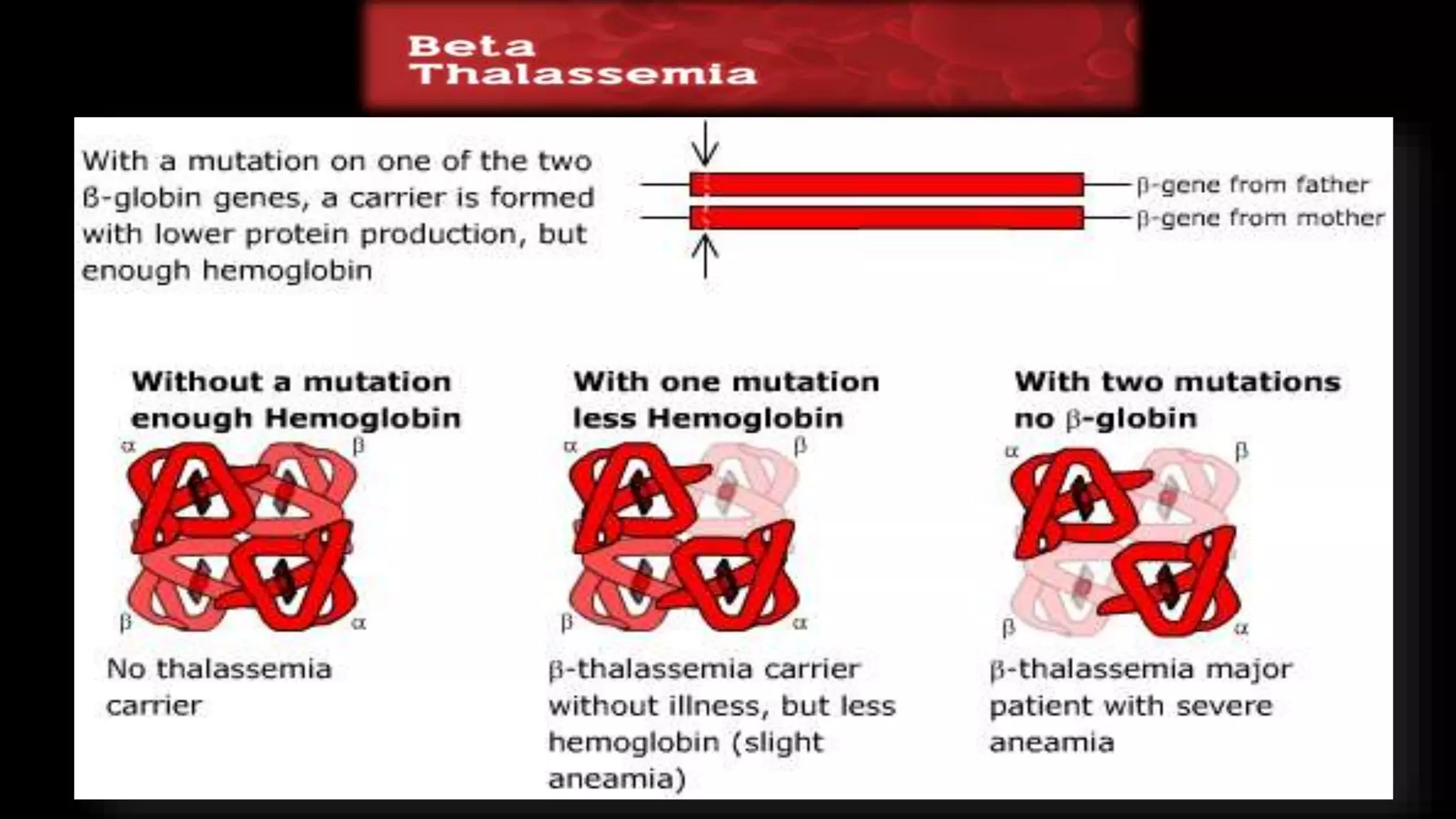 Child with pallor & jaundice (hemolytic anemia) | PPT