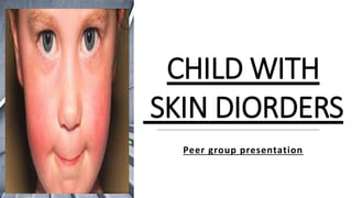 CHILD WITH
SKIN DIORDERS
Peer group presentation
 