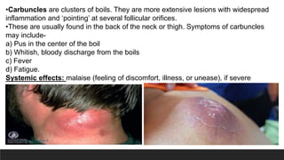 Back Carbuncle Child with skin disorder | PPTX