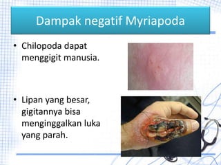 Dampak negatif Myriapoda
• Chilopoda dapat
menggigit manusia.
• Lipan yang besar,
gigitannya bisa
menginggalkan luka
yang parah.
 