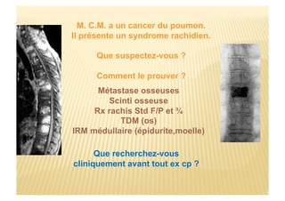 M. C.M. a un cancer du poumon.
Il présente un syndrome rachidien.
Que suspectez-vous ?
Comment le prouver ?
Métastase osseuses
Scinti osseuse
Rx rachis Std F/P et ¾
TDM (os)
IRM médullaire (épidurite,moelle)
Que recherchez-vous
cliniquement avant tout ex cp ?
 