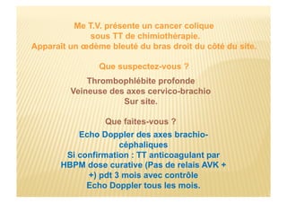Me T.V. présente un cancer colique
sous TT de chimiothérapie.
Apparaît un œdème bleuté du bras droit du côté du site.
Que suspectez-vous ?
Thrombophlébite profonde
Veineuse des axes cervico-brachio
Sur site.
Que faites-vous ?
Echo Doppler des axes brachio-
céphaliques
Si confirmation : TT anticoagulant par
HBPM dose curative (Pas de relais AVK +
+) pdt 3 mois avec contrôle
Echo Doppler tous les mois.
 