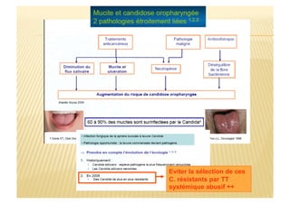 Eviter la sélection de ces
C. résistants par TT
systémique abusif ++
 
