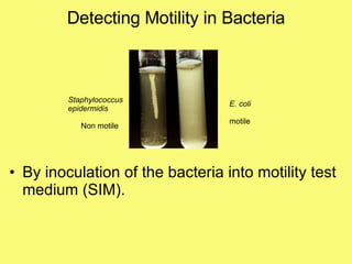 Detecting Motility in Bacteria By inoculation of the bacteria into motility test medium (SIM).   Staphylococcus epidermidis Non motile E. coli motile 