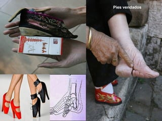 Pies vendados
 