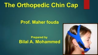 The Orthopedic Chin Cap
Prof. Maher fouda
Prepared by
Bilal A. Mohammed
Faculty of dentistry-
Mansoura university - Egypt
 