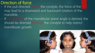 Direction of force
- If the pull directed below the condyle, the force of the
may lead to a downward and backward rotation of the
mandible.
- If no opening of the mandibular plane angle is desired, the
should be directed through the condyle to help restrict
mandibular growth.
 