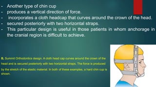 - Another type of chin cup
- produces a vertical direction of force.
- incorporates a cloth headcap that curves around the crown of the head.
- secured posteriorly with two horizontal straps.
- This particular design is useful in those patients in whom anchorage in
the cranial region is difficult to achieve.
B, Summit Orthodontics design. A cloth head cap curves around the crown of the
head and is secured posteriorly with two horizontal straps. The force is produced
by the stretch of the elastic material. In both of these examples, a hard chin cup is
shown.
 