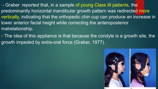 - Graber reported that, in a sample of young Class III patients, the
predominantly horizontal mandibular growth pattern was redirected more
vertically, indicating that the orthopedic chin cup can produce an increase in
lower anterior facial height while correcting the anteroposterior
malrelationship.
- The idea of this appliance is that because the condyle is a growth site, the
growth impeded by extra-oral force (Graber, 1977).
 