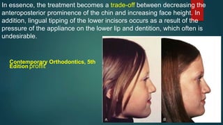 In essence, the treatment becomes a trade-off between decreasing the
anteroposterior prominence of the chin and increasing face height. In
addition, lingual tipping of the lower incisors occurs as a result of the
pressure of the appliance on the lower lip and dentition, which often is
undesirable.
Contemporary Orthodontics, 5th
Edition proffit
 