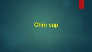Chin cap
 