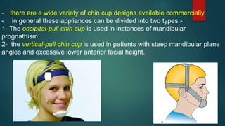 - there are a wide variety of chin cup designs available commercially.
- in general these appliances can be divided into two types:-
1- The occipital-pull chin cup is used in instances of mandibular
prognathism.
2- the vertical-pull chin cup is used in patients with steep mandibular plane
angles and excessive lower anterior facial height.
 