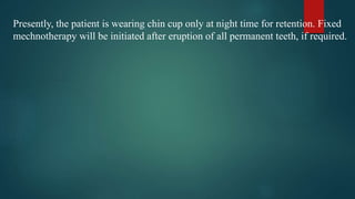 Presently, the patient is wearing chin cup only at night time for retention. Fixed
mechnotherapy will be initiated after eruption of all permanent teeth, if required.
 