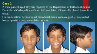 Case 2
A male patient aged 10 years reported to the Department of Orthodontics and
Dentofacial Orthopedics with a chief complaint of forwardly placed lower front
teeth.
On examination, he was found mesofacial, had a concave profile, an everted
lower lip with a deep mentolabial sulcus.
 