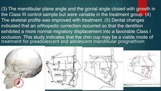 (3) The mandibular plane angle and the gonial angle closed with growth in
the Class III control sample but were variable in the treatment group. (4)
The skeletal profile was improved with treatment. (5) Dental changes
indicated that an orthopedic correction occurred so that the dentition
exhibited a more normal migratory displacement into a favorable Class I
occlusion. This study indicates that the chin cup may be a viable mode of
treatment for preadolescent and adolescent mandibular prognathism
patients.
 