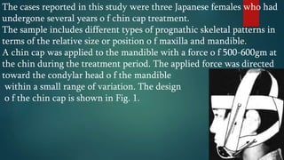 The cases reported in this study were three Japanese females who had
undergone several years o f chin cap treatment.
The sample includes different types of prognathic skeletal patterns in
terms of the relative size or position o f maxilla and mandible.
A chin cap was applied to the mandible with a force o f 500-600gm at
the chin during the treatment period. The applied force was directed
toward the condylar head o f the mandible
within a small range of variation. The design
o f the chin cap is shown in Fig. 1.
 
