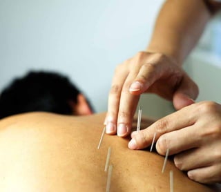 Acupuncture can help cancer patients