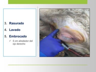 3. Rasurado
4. Lavado
5. Embrocado
 5 cm alrededor del
ojo derecho
 