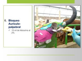 6. Bloqueo
Auriculo-
palpebral
 15 ml de lidocaína al
2%
 
