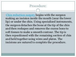 Chin reduction surgery Slide 3