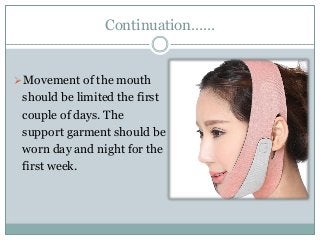 Chin reduction surgery Slide 6