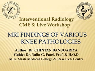 MRI FINDINGS OF VARIOUS
KNEE PATHOLOGIES
Interventional Radiology
CME & Live Workshop
Author: Dr. CHINTAN BANUGARIYA
Guide: Dr. Nalin G. Patel, Prof. & H.O.D
M.K. Shah Medical College & Research Centre
 