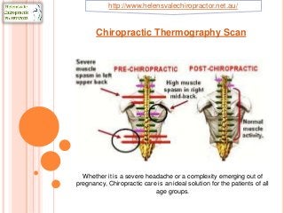Chiropractic Thermography Scan
Whether it is a severe headache or a complexity emerging out of
pregnancy, Chiropractic care is an ideal solution for the patients of all
age groups.
http://www.helensvalechiropractor.net.au/
 