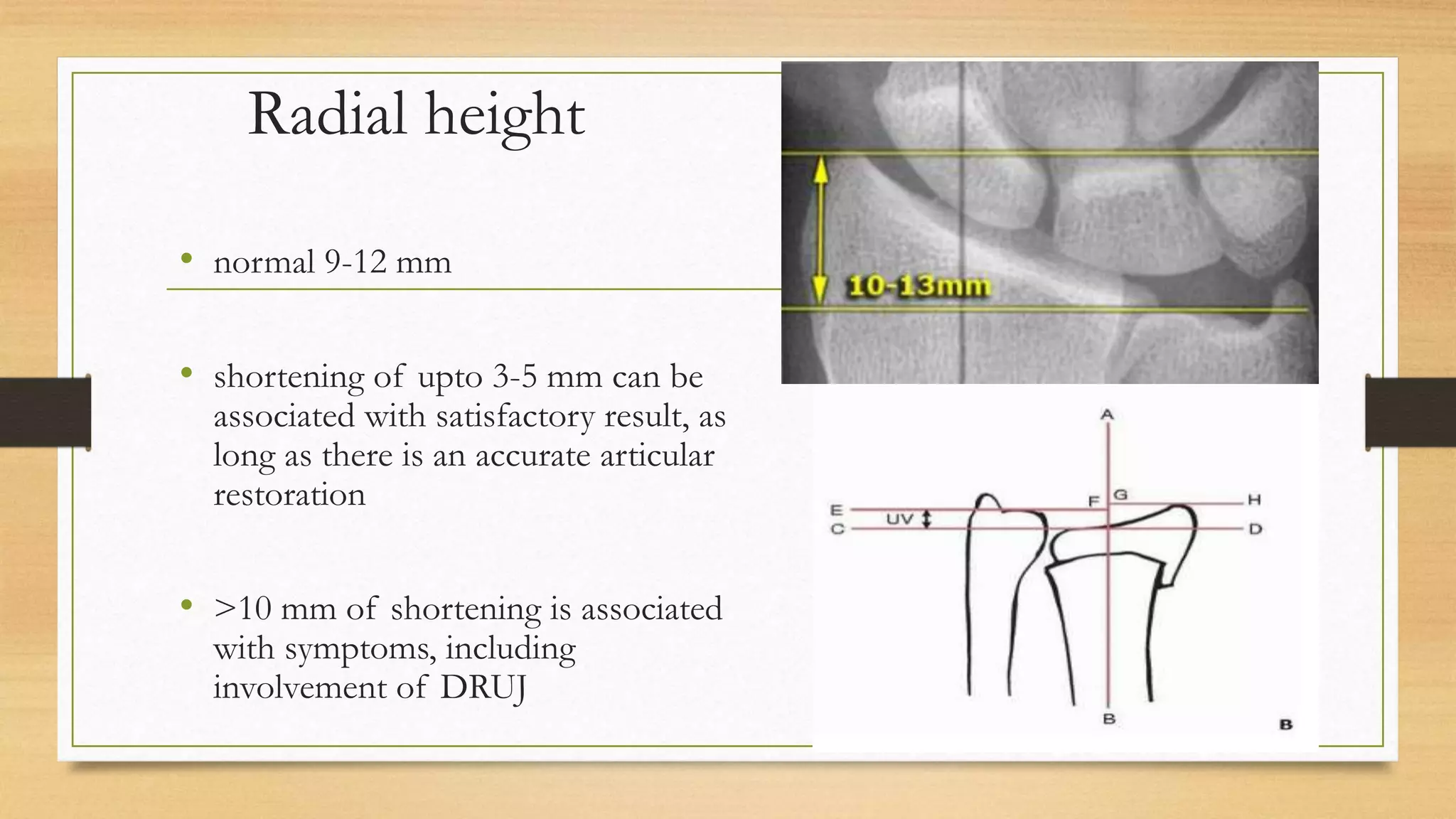 distal radius # ppt | PPTX