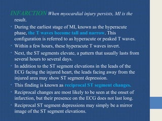 INFARCTION When myocardial injury persists, MI is the
result.
• During the earliest stage of MI, known as the hyperacute
phase, the T waves become tall and narrow. This
configuration is referred to as hyperacute or peaked T waves.
• Within a few hours, these hyperacute T waves invert.
• Next, the ST segments elevate, a pattern that usually lasts from
several hours to several days.
• In addition to the ST segment elevations in the leads of the
ECG facing the injured heart, the leads facing away from the
injured area may show ST segment depression.
• This finding is known as reciprocal ST segment changes.
• Reciprocal changes are most likely to be seen at the onset of
infarction, but their presence on the ECG does not last long.
• Reciprocal ST segment depressions may simply be a mirror
image of the ST segment elevations.
 