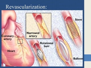 Revascularization:
 