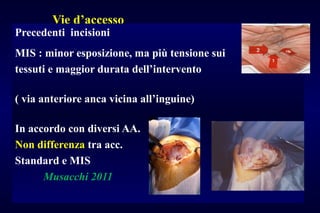 Vie d’accesso
Precedenti incisioni
MIS : minor esposizione, ma più tensione sui
tessuti e maggior durata dell’intervento
( via anteriore anca vicina all’inguine)
In accordo con diversi AA.
Non differenza tra acc.
Standard e MIS
Musacchi 2011
 